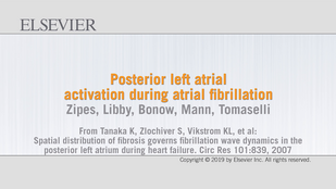 Обложка: Видео 34.3. Активация задней стенки левого предсердия при фибрилляции предсердий...см. далее стр. XXi