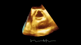 Обложка: Рис. 2.14 Усиление. Видео В Коэффициент усиление повышен