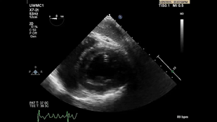 Обложка: Рис. 3.6 Визуализация из трансгастрального доступа. Видео В Позиция среднего отдела левого желудочка по короткой оси