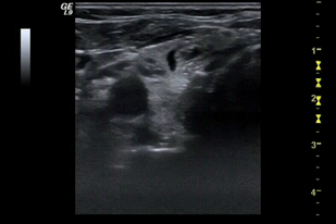 Обложка: 1.2 Нормальная анатомия шеи и щитовидной железы в поперечном сечении